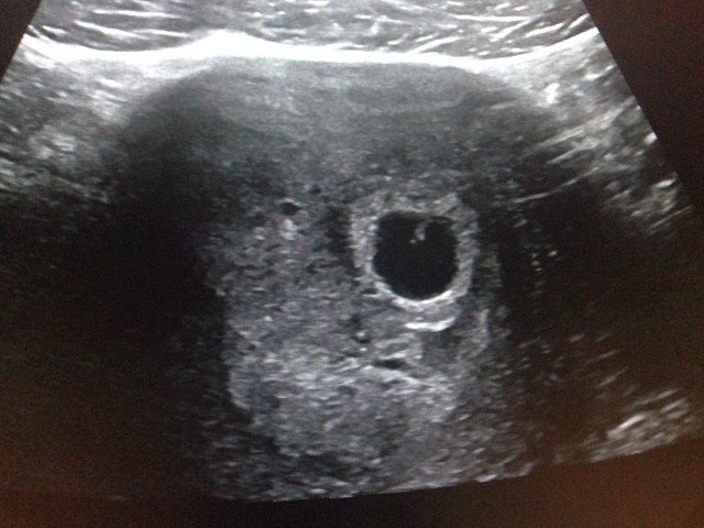 Bittelille bølle! Sånn ca i slutten av uke 6. Sykt søt, ikke sant?!